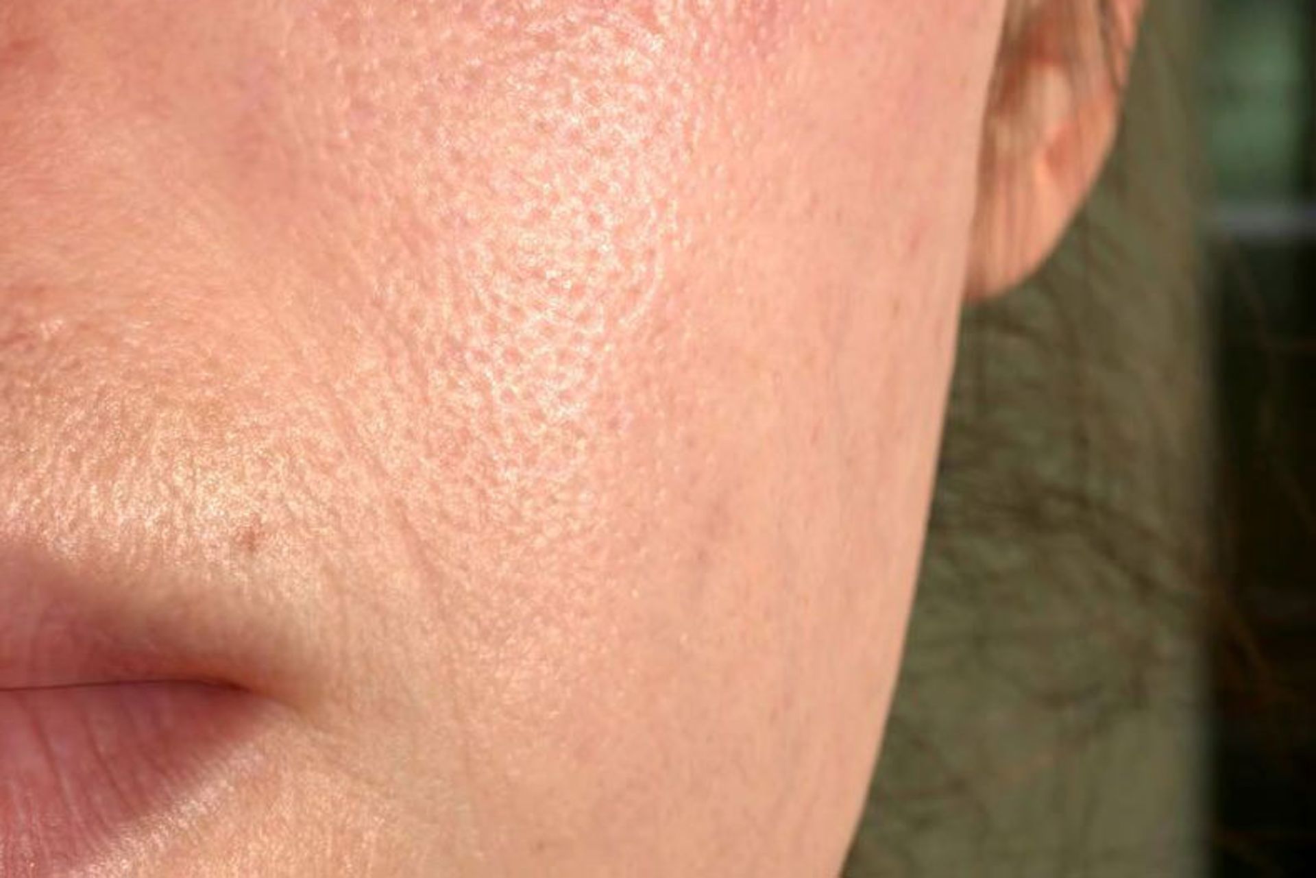 Simulating Dynamic Skin