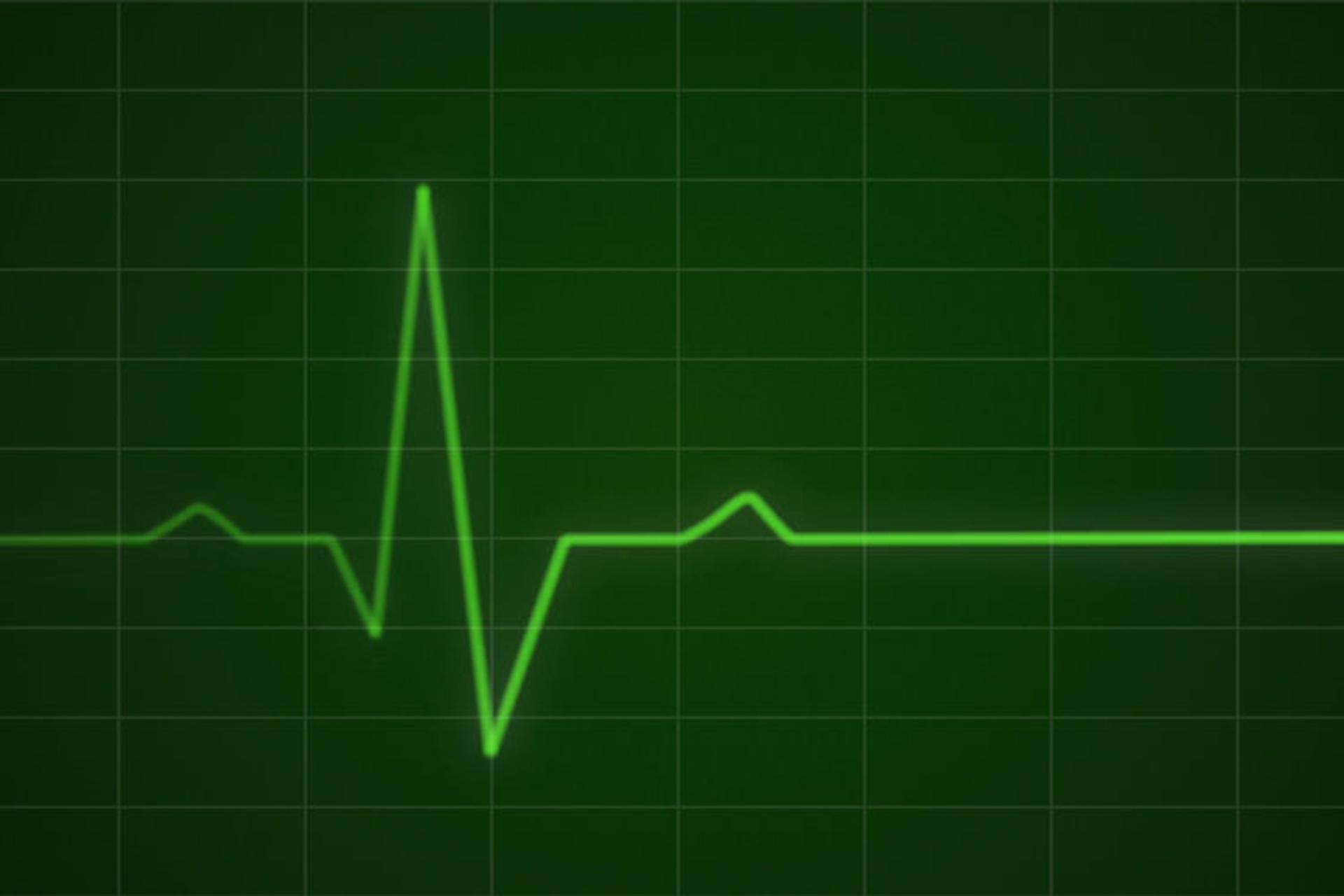 heart graph