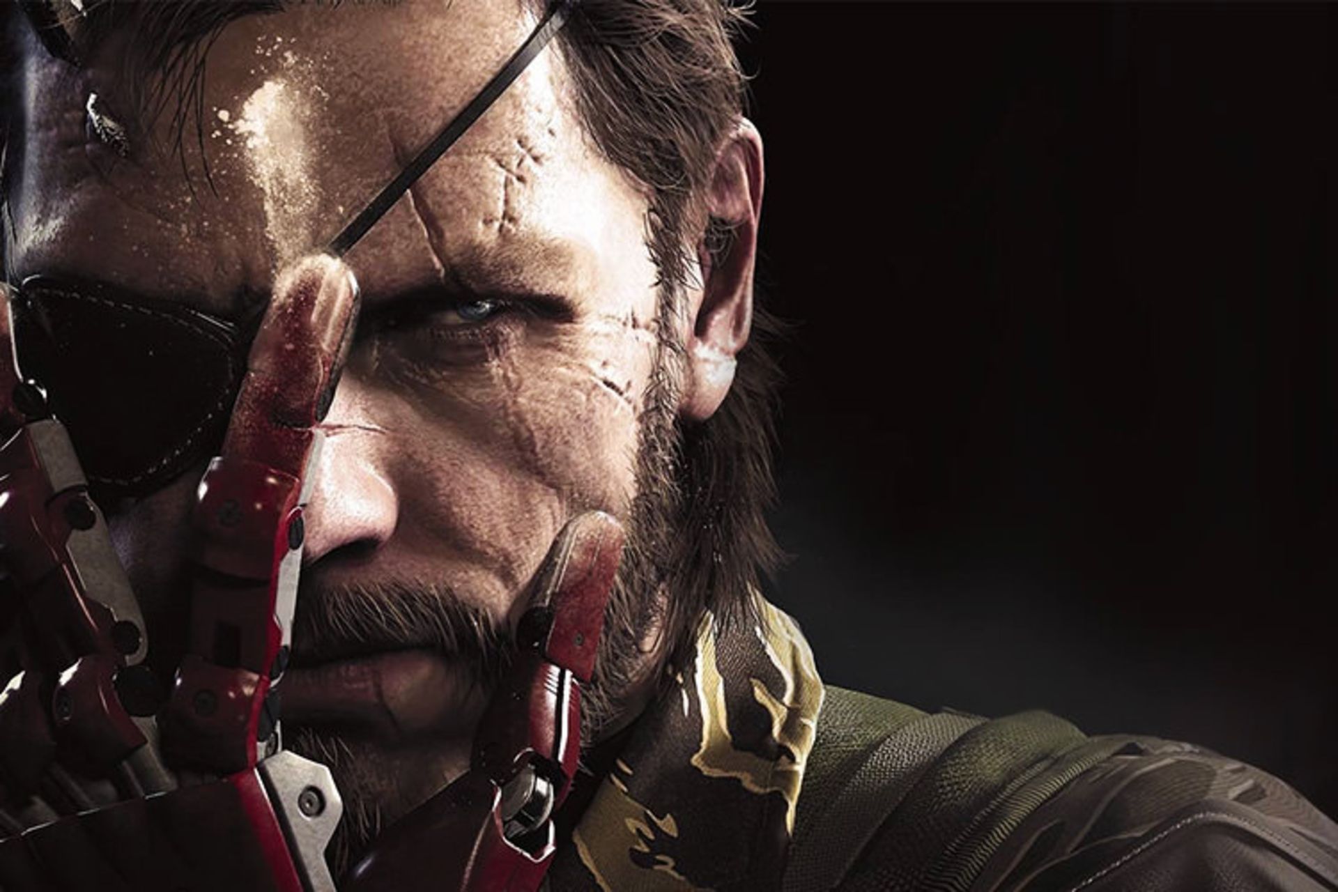 MGS