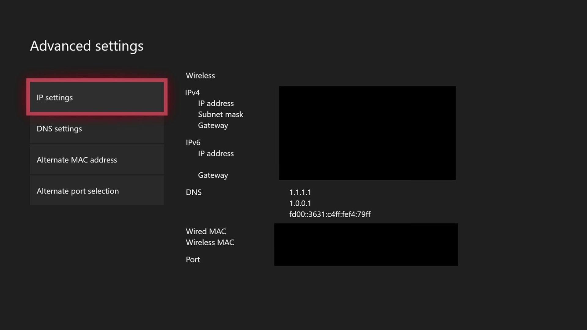 2020-11-xbox-advanced-settings-dns