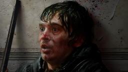 چهره مردی زخمی و وحشت‌زده در فیلم رزیدنت ایول (Resident Evil)