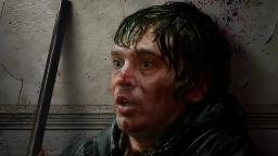 چهره مردی زخمی و وحشت‌زده در فضای تاریک فیلم رزیدنت اویل (Resident Evil)