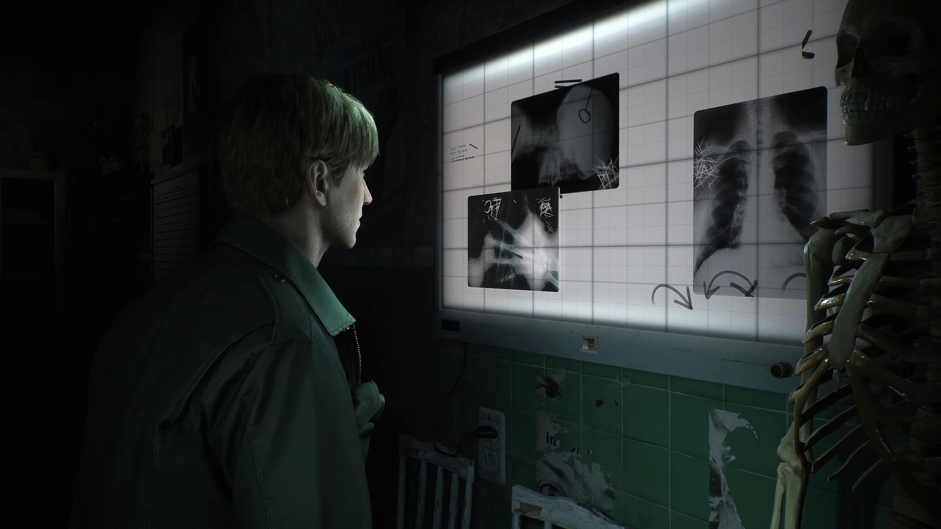 James Sunderland (جیمز ساندرلند) مشغول تماشای عکس رادیوگرافی در بازی Silent Hill 2